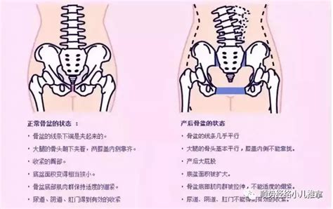 骨盆有痣